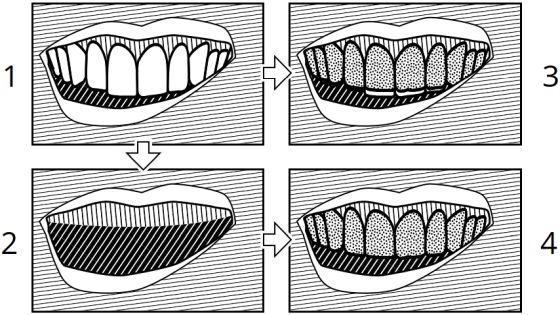 Rendering A Dental Model In An Image